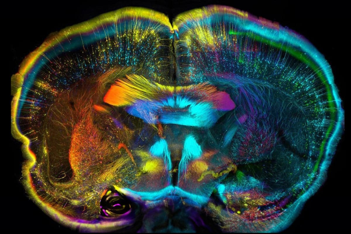 Does 15 Minutes Of FGF21 Activity Support Brain Health?