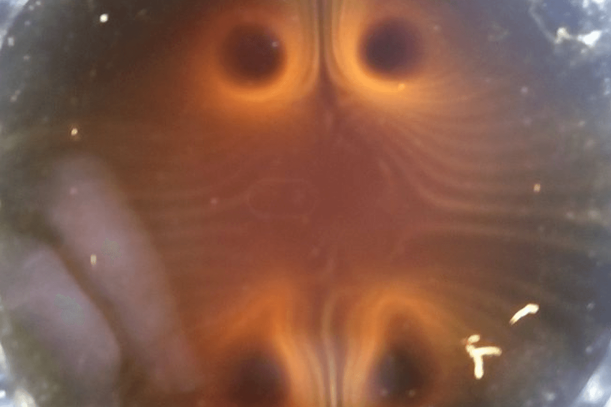 Should I Be Worried About EMF Exposure?