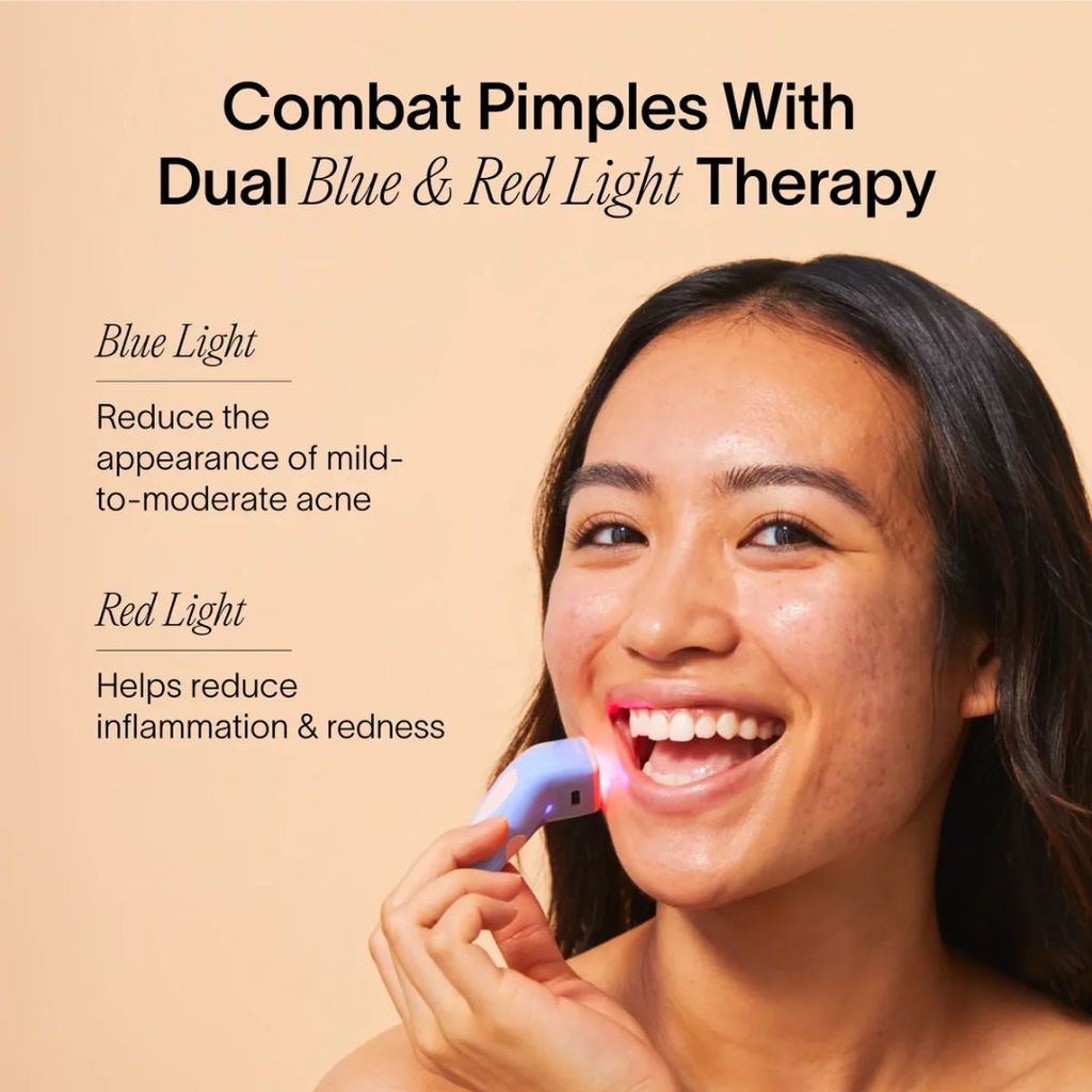3-Minute Pimple Spot Treatment - Periwinkle - Image 3
