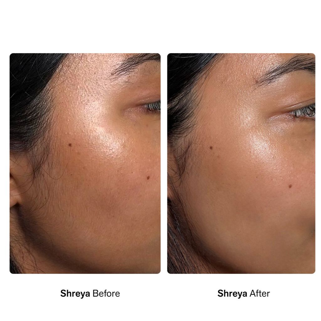 Pillow Slip Facial Dermaplaner Oil - Image 7