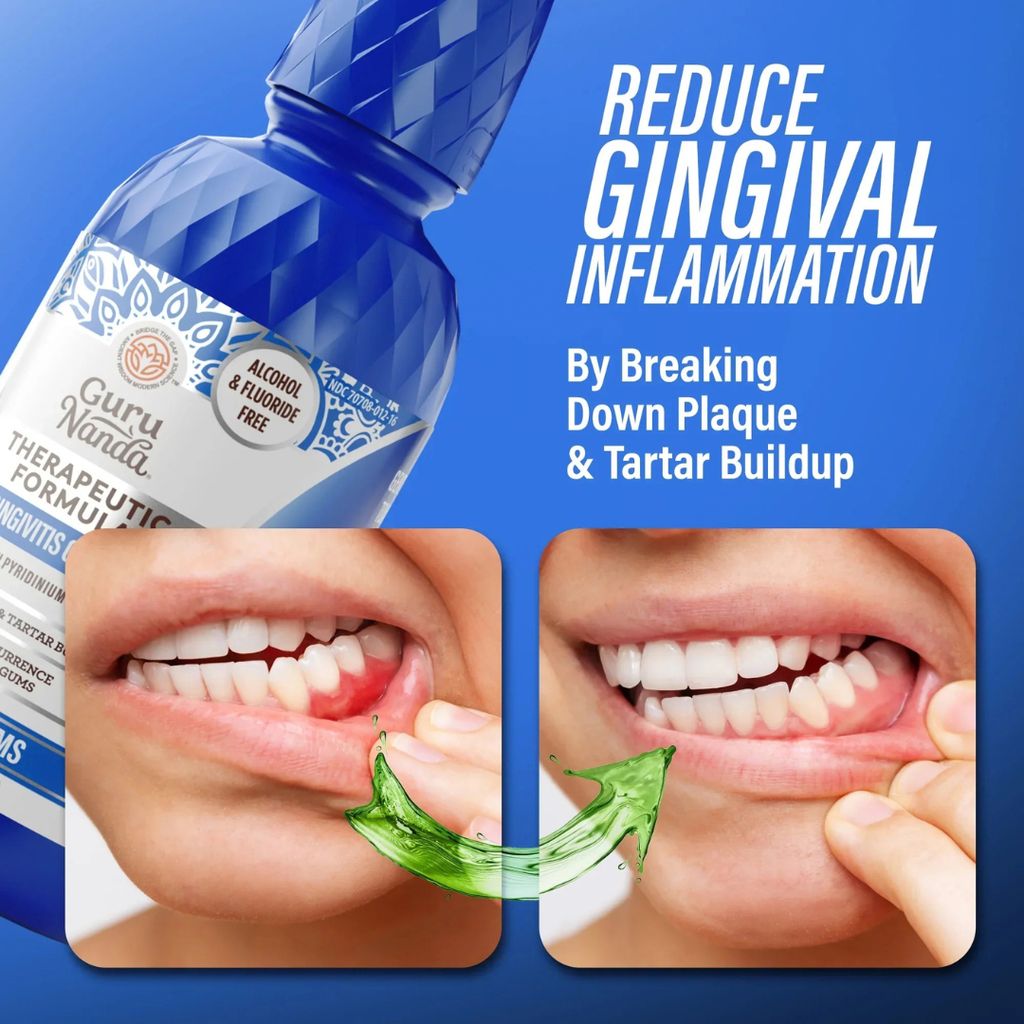 Healthy Gums Anti-Gingivitis Oral Rinse (Wild Mint) - Image 3