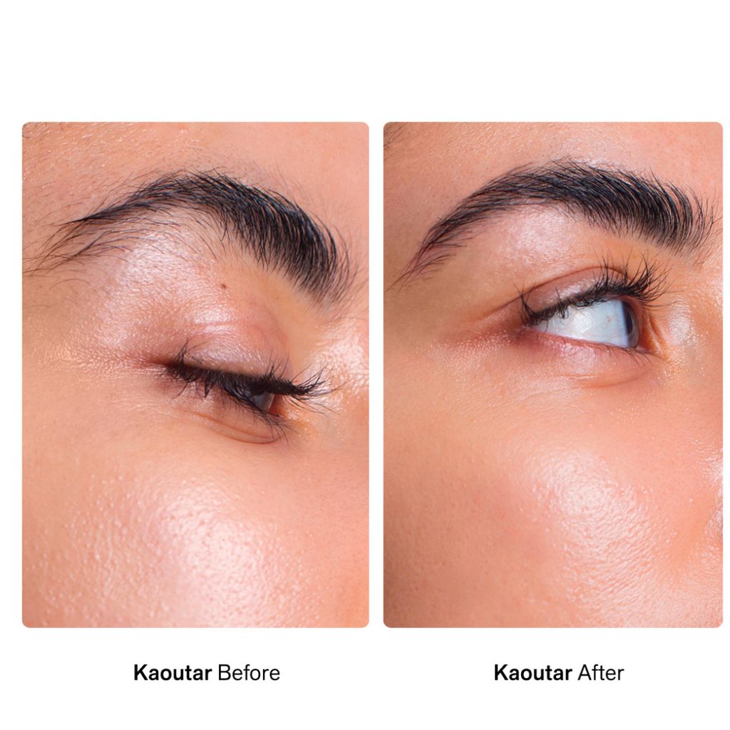 Facial Dermaplaners - Image 7