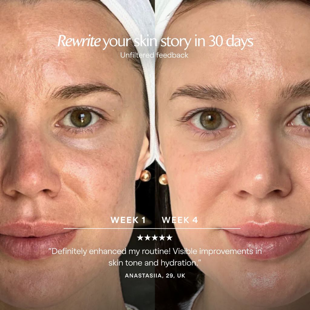 LumaLux Face Pro LED Red Light Therapy Mask - Image 4