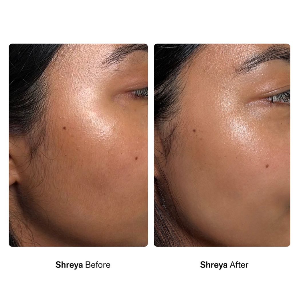 Facial Dermaplaners - Image 6