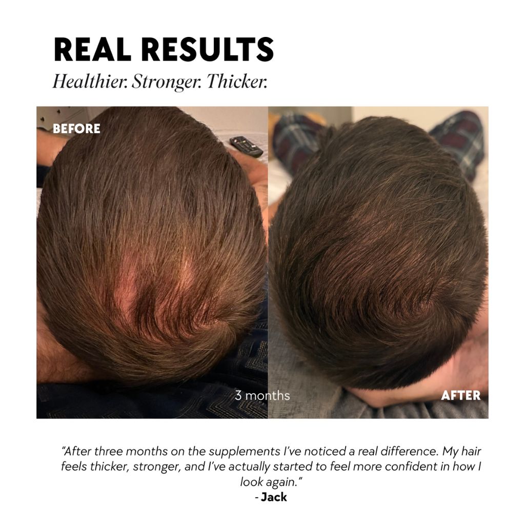 Tender Love and Hair - Men's Hair Vitamins - Image 5