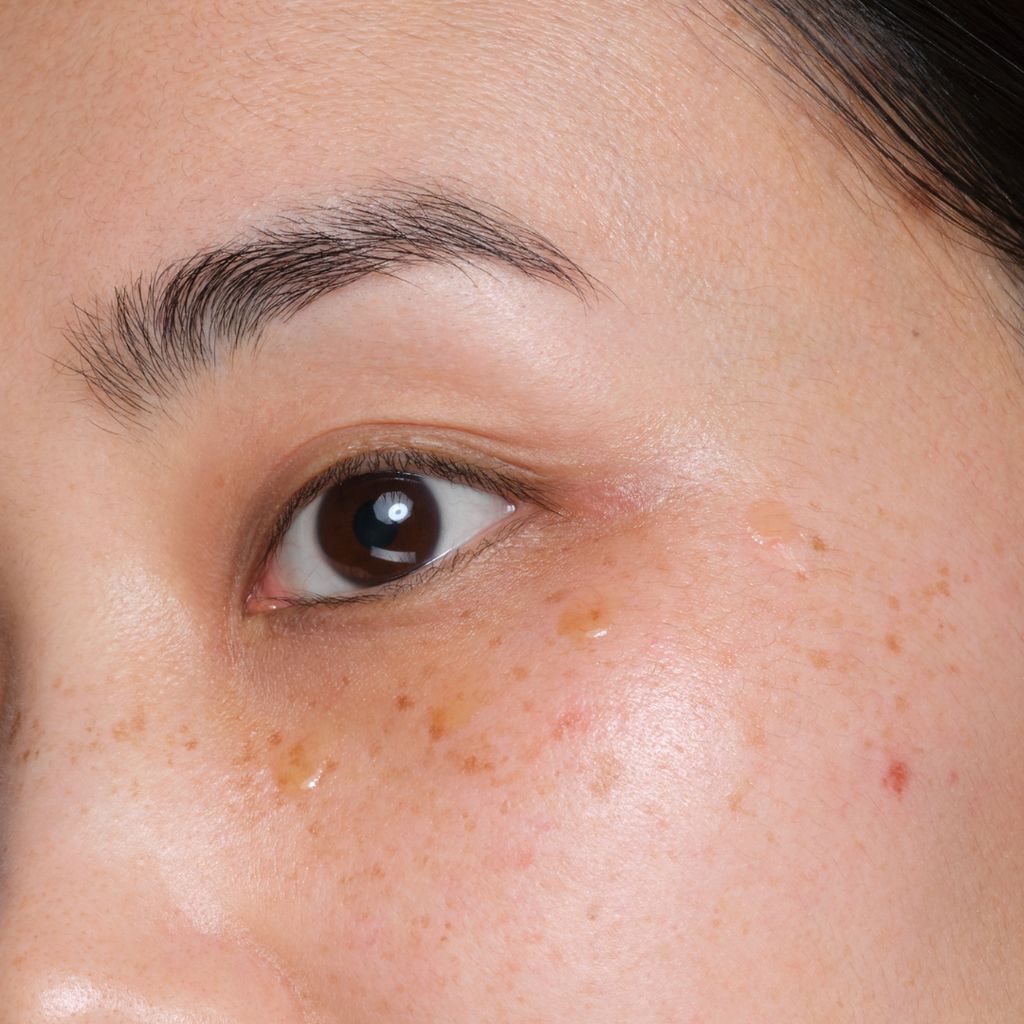 Fractionated Eye-Contour Concentrate - Image 6