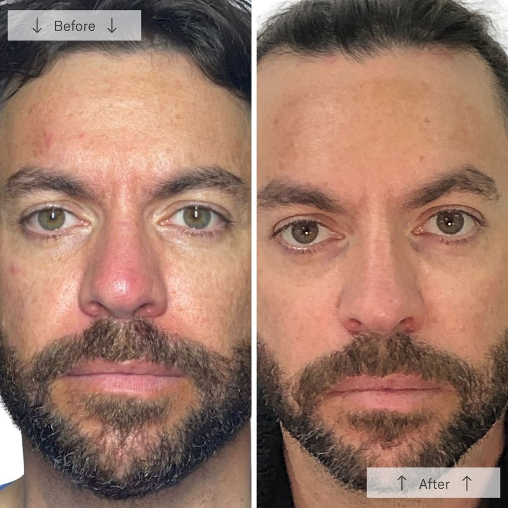 Omnilux Men - Image 7