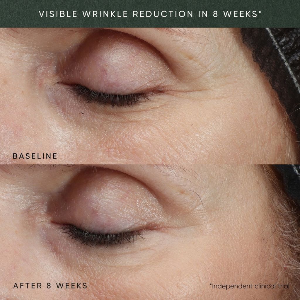 Phytomelatonin Rejuvenating Eye Cream With Dr. Ferri APM™ & Phyto-Exosomes - Image 7
