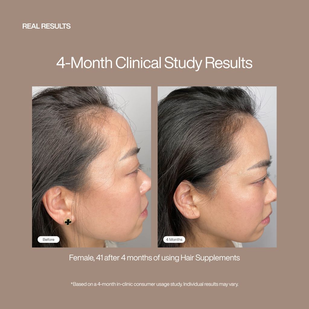 Hair Supplements - Image 8