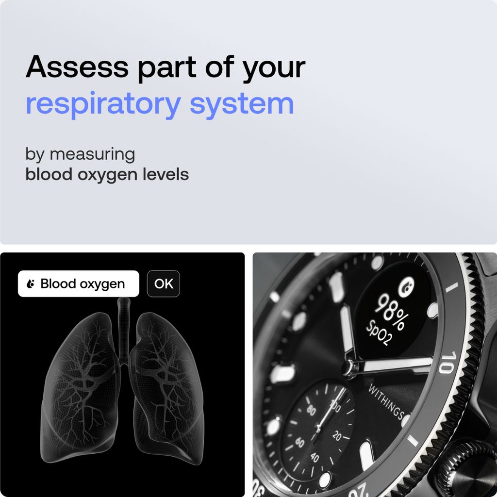 Scanwatch Nova - Black - Image 4