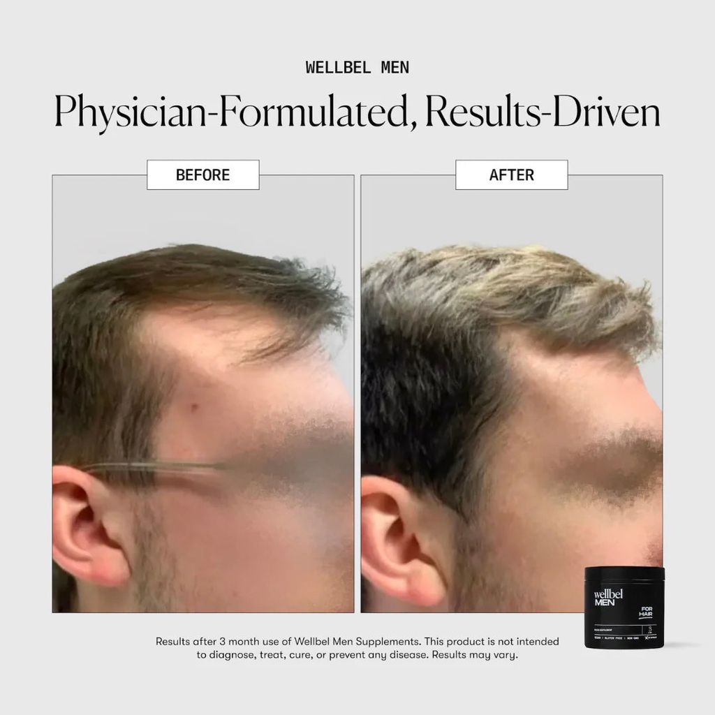 Men Hair Supplement - Image 7